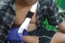 Siswa berinisial P yang mengalami patah tulang saat mendapat perawatan medis di RSD Nganjuk, Rabu (5/8/2026).