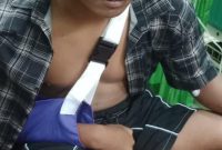 Siswa berinisial P yang mengalami patah tulang saat mendapat perawatan medis di RSD Nganjuk, Rabu (5/8/2026).