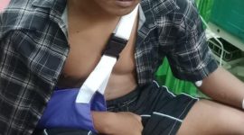 Siswa berinisial P yang mengalami patah tulang saat mendapat perawatan medis di RSD Nganjuk, Rabu (5/8/2026).