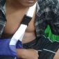 Siswa berinisial P yang mengalami patah tulang saat mendapat perawatan medis di RSD Nganjuk, Rabu (5/8/2026).